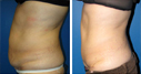 Before & After Photos